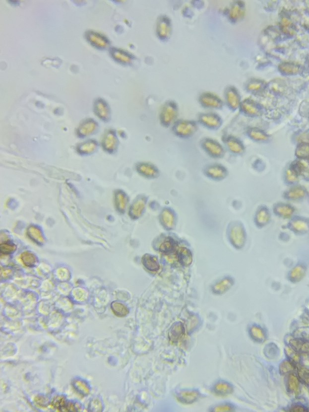 Eine Nahaufnahme-Mikroskop-Aufnahme von kleinen,.clusterierten Mikroorganismen.